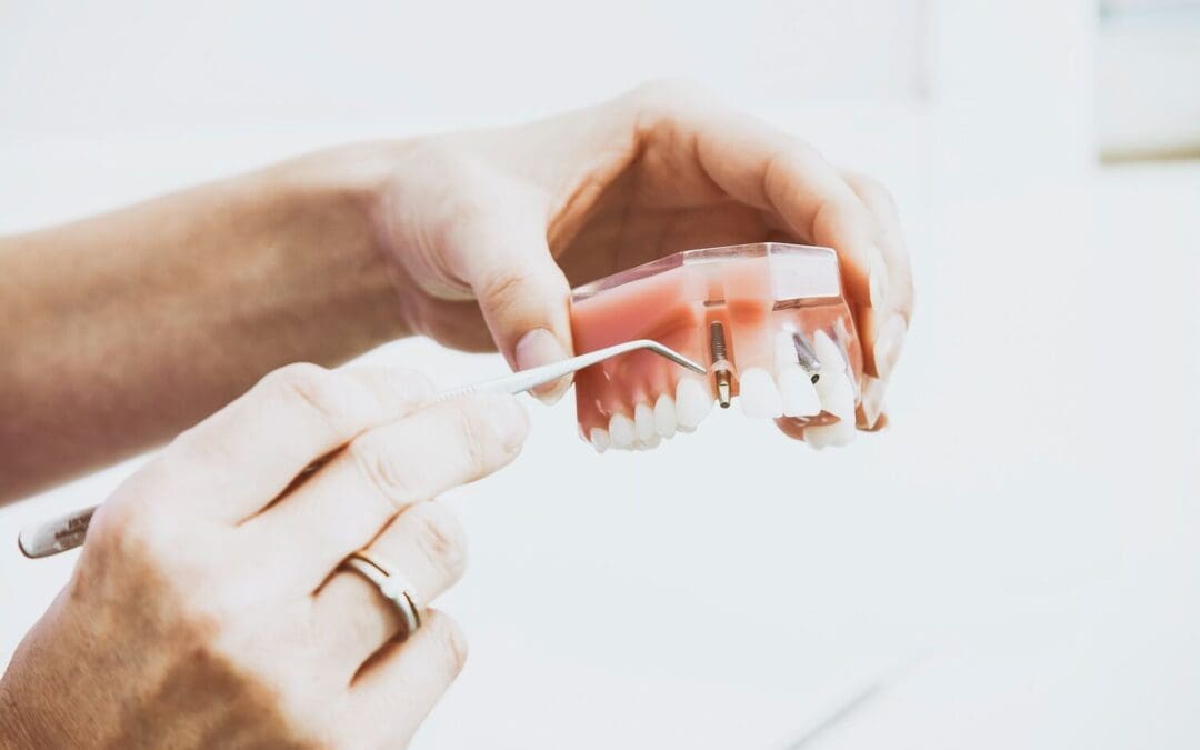 Dental Implant Marketing: How to Attract More Implant Cases