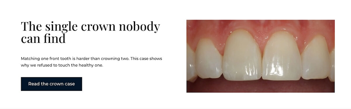 Paul Mundl DDS patient testimonial